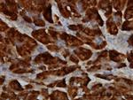 SPINK1 Monoclonal Antibody (4D4)