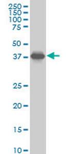 SPP1 Monoclonal Antibody (4E6)
