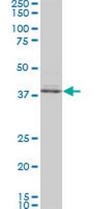 SPP1 Monoclonal Antibody (3E11)