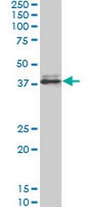 SPP1 Monoclonal Antibody (4F2)