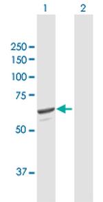 SQLE Polyclonal Antibody, MaxPab™