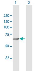 SQLE Polyclonal Antibody, MaxPab™