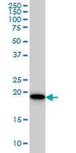 SRI Monoclonal Antibody (1E12)