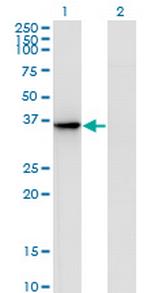 AKR1D1 Monoclonal Antibody (1A6)