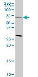 SRF Monoclonal Antibody (1C8)