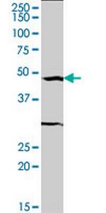 SRF Monoclonal Antibody (2C9)