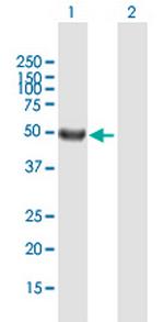 SRMS Polyclonal Antibody, MaxPab™