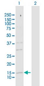 SRP19 Polyclonal Antibody, MaxPab™