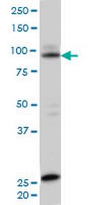 SRPK1 Monoclonal Antibody (2E8)