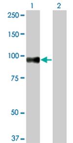 SRPK1 Monoclonal Antibody (6G9)