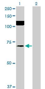 SRPK2 Antibody in Western Blot (WB)