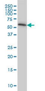 TROVE2 Antibody in Western Blot (WB)