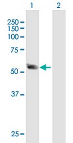 SSB Antibody in Western Blot (WB)