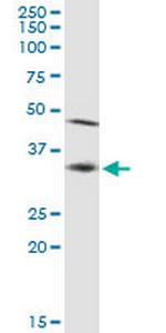 SSR1 Polyclonal Antibody, MaxPab™