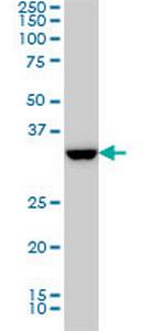 SSR1 Monoclonal Antibody (1A12)