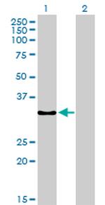 SSR1 Antibody in Western Blot (WB)