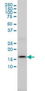 SSR4 Monoclonal Antibody (2D3)