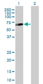SSTR5 Polyclonal Antibody, MaxPab™