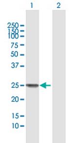SSX1 Polyclonal Antibody, MaxPab™
