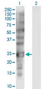 SSX1 Monoclonal Antibody (5B2)