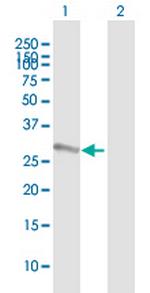 SSX2 Polyclonal Antibody, MaxPab™