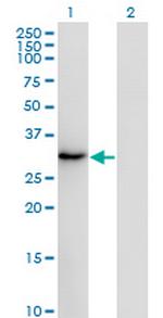 SSX2 Monoclonal Antibody (1A4)