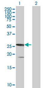 SSX5 Polyclonal Antibody, MaxPab™