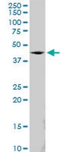 SS18 Polyclonal Antibody, MaxPab™