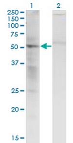 SS18 Monoclonal Antibody (1C8)