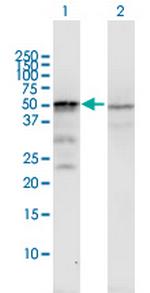 ST13 Antibody in Western Blot (WB)