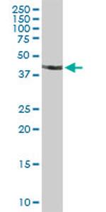 STAC Antibody in Western Blot (WB)