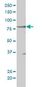 STAT5B Monoclonal Antibody (1A1)
