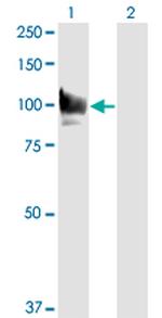 STAT6 Antibody in Western Blot (WB)