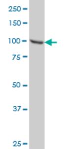 STAT6 Antibody in Western Blot (WB)