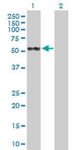 STCH Polyclonal Antibody, MaxPab™