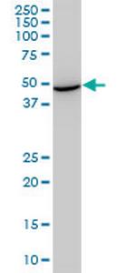 STCH Monoclonal Antibody (1H8)