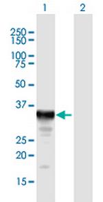 SULT1E1 Polyclonal Antibody, MaxPab™