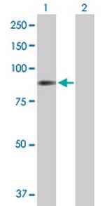 STIM1 Antibody in Western Blot (WB)