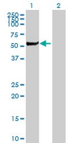STK3 Antibody in Western Blot (WB)