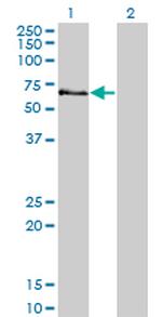STK3 Antibody in Western Blot (WB)