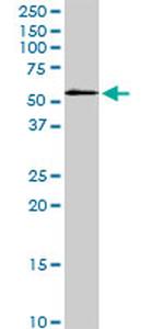 STK3 Antibody in Western Blot (WB)