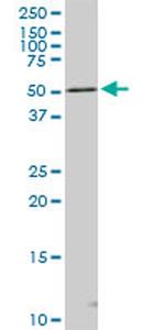 STK4 Antibody in Western Blot (WB)