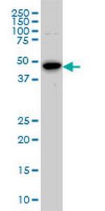 AURKA Monoclonal Antibody (5F8)