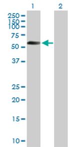 STK11 Antibody in Western Blot (WB)