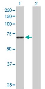 STXBP1 Polyclonal Antibody, MaxPab™