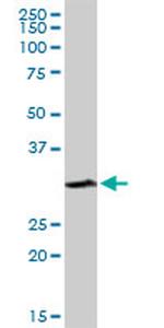 SULT1A1 Antibody in Western Blot (WB)