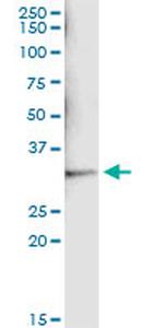 SULT1A1 Antibody in Immunoprecipitation (IP)