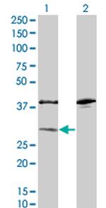 SULT1A1 Antibody in Western Blot (WB)