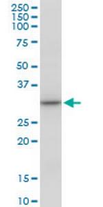 SULT1A3 Polyclonal Antibody, MaxPab™