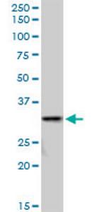 SULT1A3 Polyclonal Antibody, MaxPab™